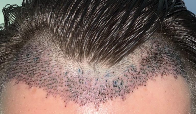 How Much You Need To Expect You’ll Pay For A Good Hair
